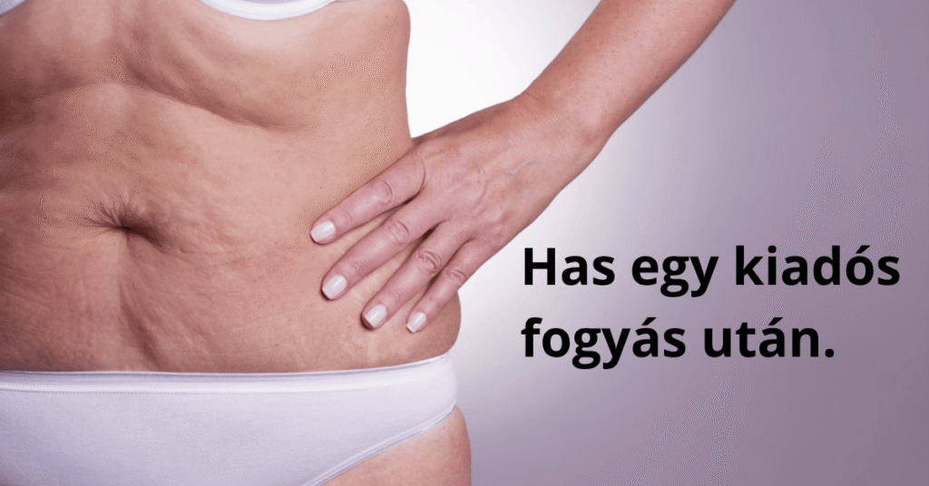 has fogyás után